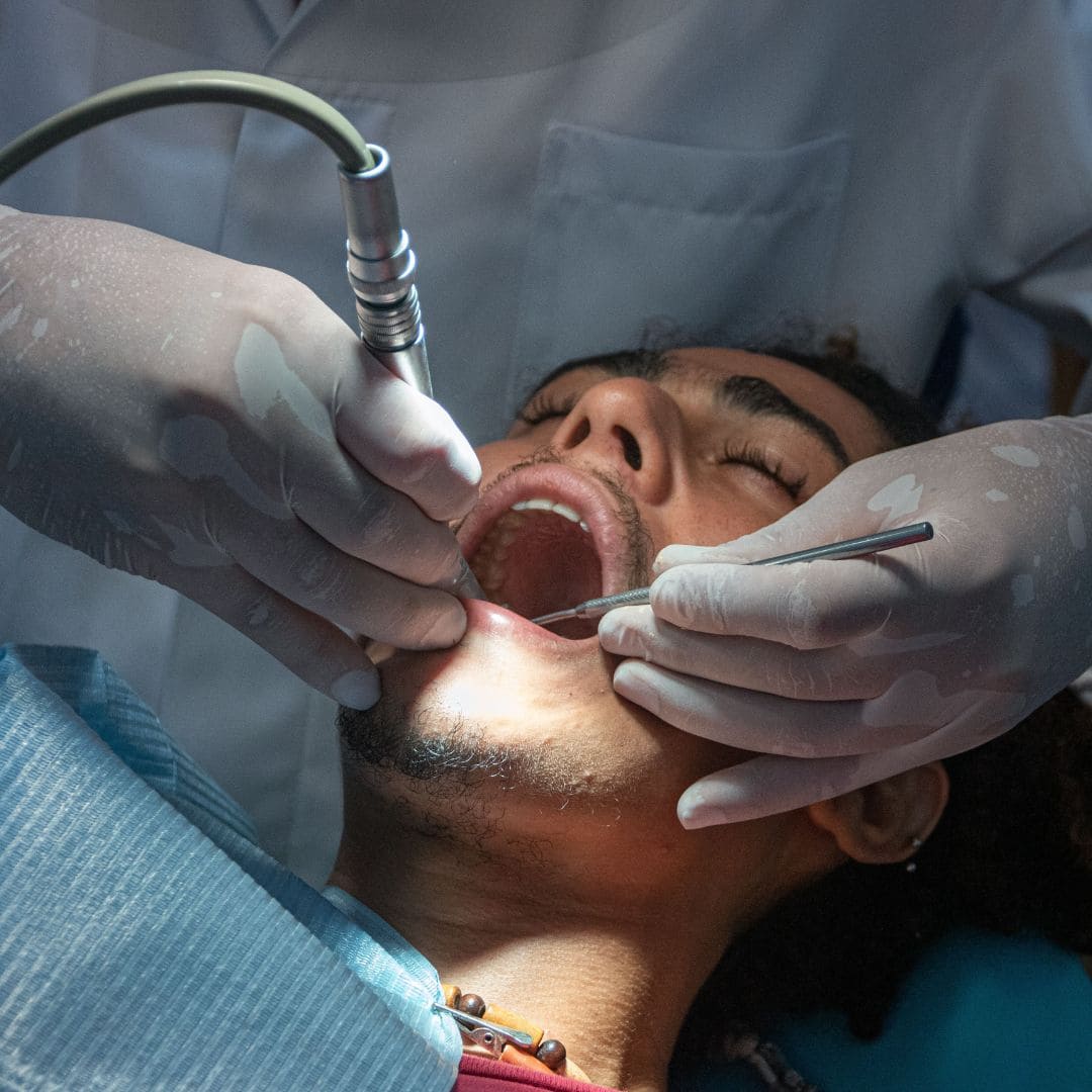blanqueamiento dental jaen