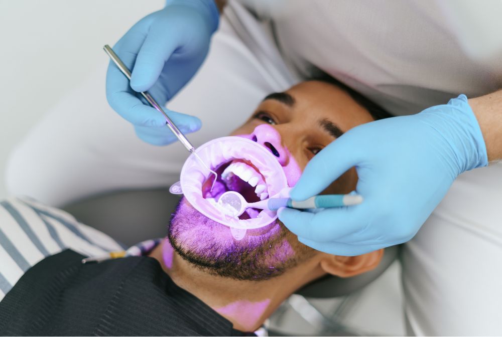 blanqueamiento dental en jaen