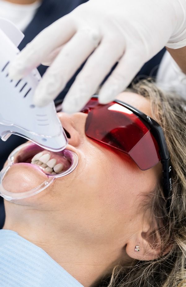 estética dental en jaén