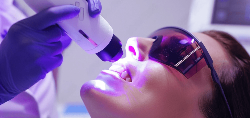 es seguro el blanqueamiento dental