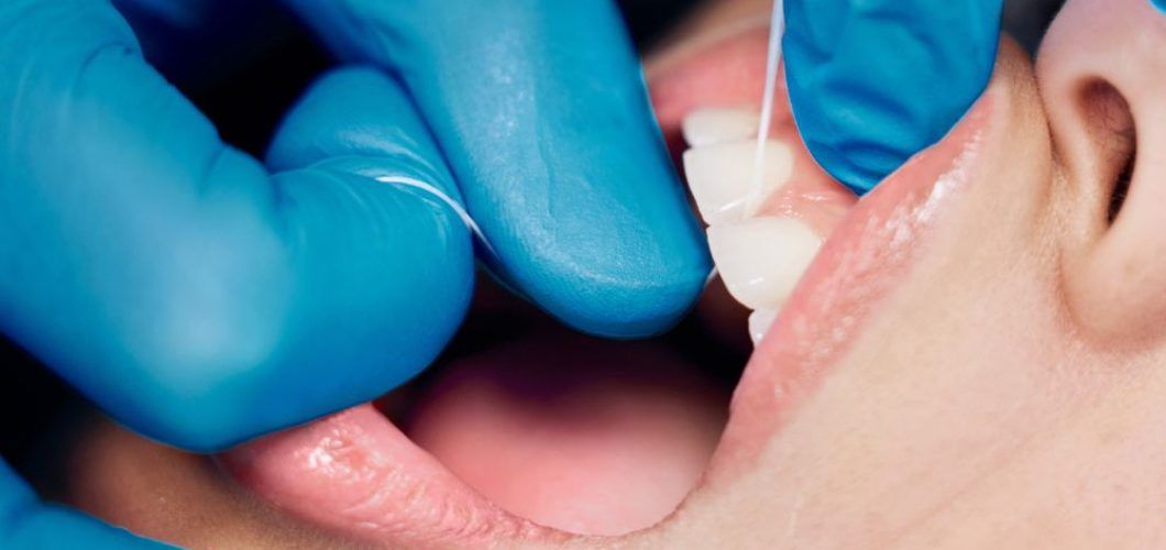 remedios caseros periodontitis
