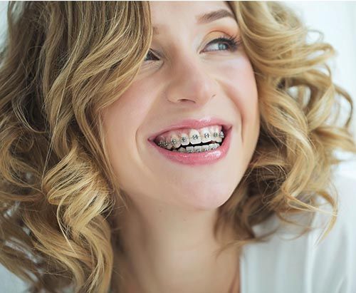 ortodoncia brackets jaen