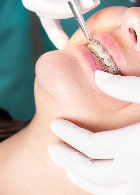 brackets ortodoncia jaen
